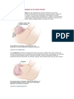 Onfalocele y Gastrosquisis en El Recién Nacido