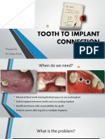 Tooth To Implant Connection