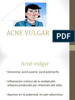Acne Vulgar