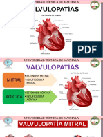 VALVULOPATÍAS