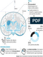 2HEMORRAGIA-CEREBRO_MAY5.pdf