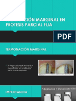 Terminación Marginal en Protesis Parcial Fija