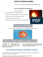 Glaucoma de tensión normal y ángulo cerrado