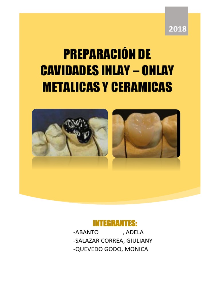 Preparación de cavidades inlay-onlay metálicas y cerámicas ...