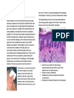 Actinic Keratosis