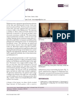 Maduromycosis of Foot: Mrinal Gupta