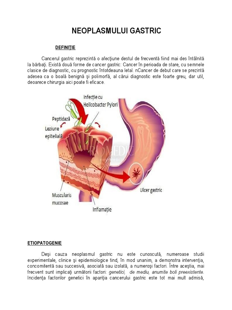 cancerul gastric este localizat in regiunea condyloma acuminatum genital