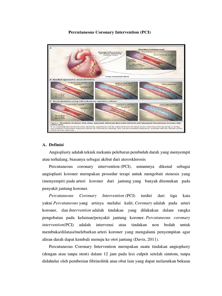 Percutaneous Coronary Intervention | PDF