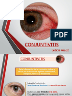 Conjuntivitis Charla