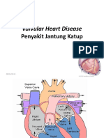 Valvular Heart Disease: Penyakit Jantung Katup