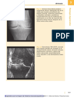 Diagnóstico Por La Imagen Del Sistema Musculoesquelético2011