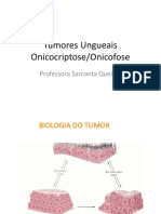 Tumores Ungueais: Diagnóstico e Tratamento