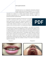 caso clinico diente supernumerario.docx
