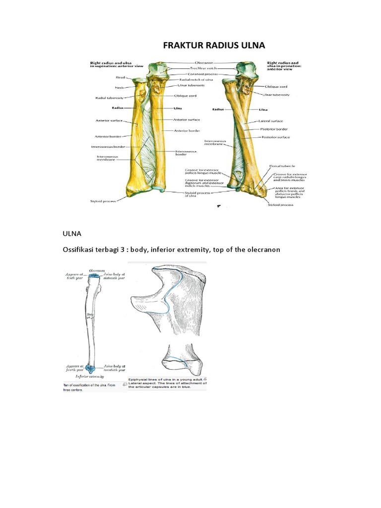 Fraktur Radius Ulna | PDF