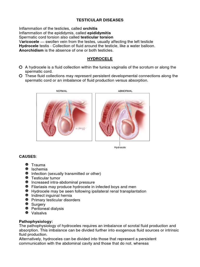 Testicular Diseases Orchitis Epididymitis Testicular Torsion Aricocele Hydrocele Anorchidism