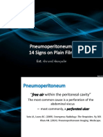 pneumoperitoneumsigns-140810105221-phpapp02.pdf