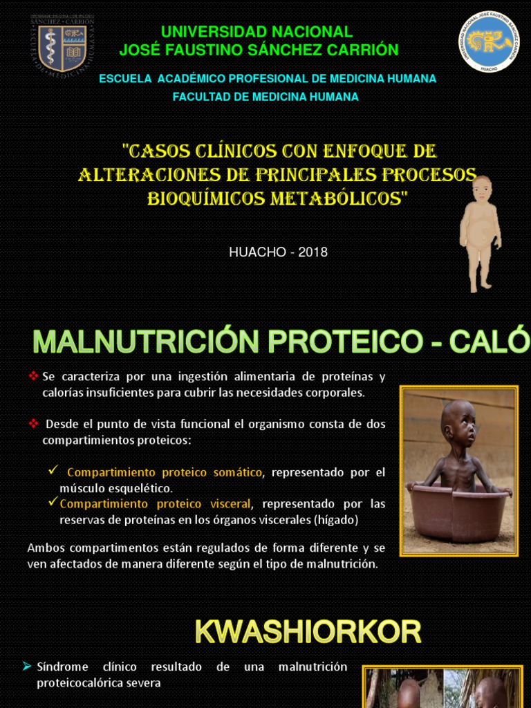 Kwashiorkor | PDF | Diabetes mellitus | Enfermedades y trastornos