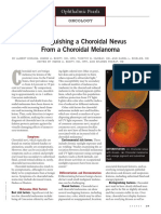 Distinguishing A Choroidal Nevus From A Choroidal Melanoma PDF