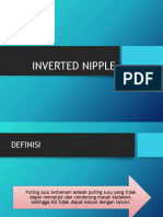Inverted Nip