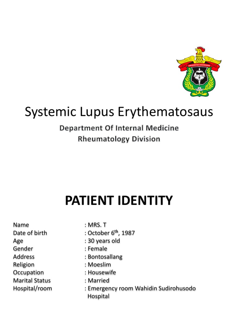 Systemic Lupus Erythematosus | PDF | Systemic Lupus Erythematosus ...