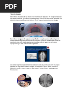 Escrito Generalidades