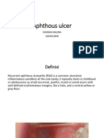 Causes and Treatment of Aphthous Ulcers