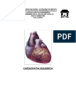 Cardiopatía Isquemica