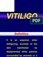 Kelainan Pigmentasi Vitiligo