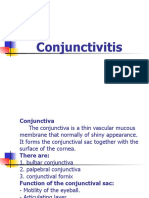 Conjunctivitis 09