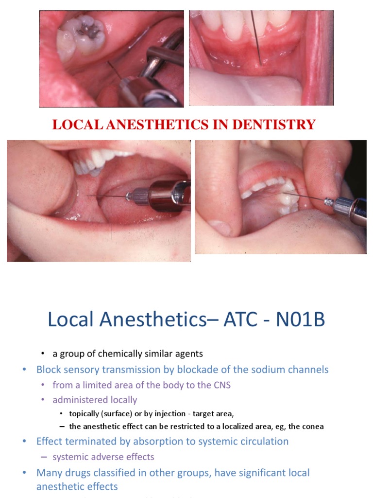 Local Anesthetics Overview in Dentistry | PDF | Medical Specialties | Drugs