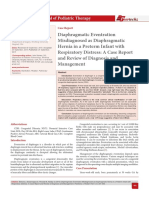Diaphragmatic Eventration misdiagnosis with hernia diafragma.pdf
