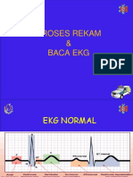 199613883-EKG-normal-btcls-ppt.ppt