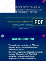 Closing PDA with Amplatzer Device