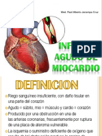 Infartoagudodemiocardio