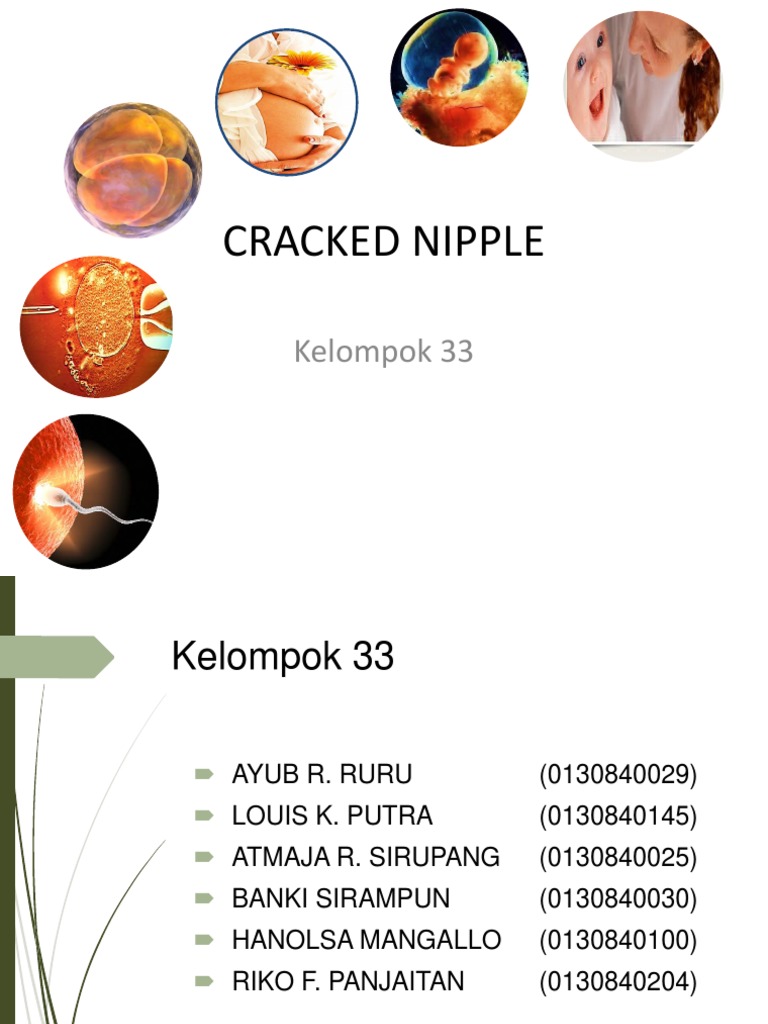 understanding-cracked-nipples-in-nursing-pdf
