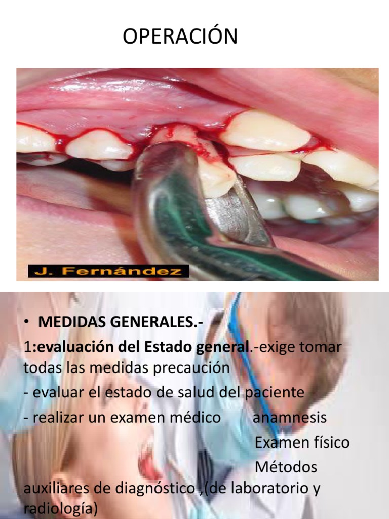 Operacion Cirugia Hueso