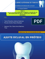 Ajuste oclusal y acabado de restauraciones