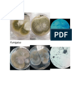 Imágenes Aspergillus