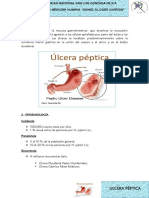 Úlcera péptica: definición, epidemiología, etiología y tratamiento