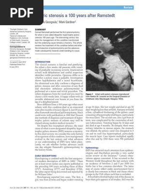 Stenosis Pilorus Pdf Gastrointestinal Tract Biology