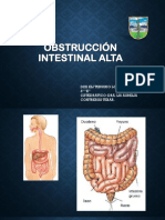 Obstrucción intestinal alta en
