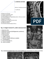 Anatomia Columna