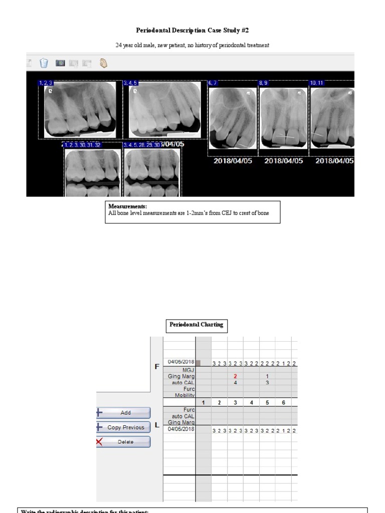 Periocasestudy 2 | PDF