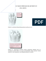 Gambar Urutan Tahapan Preparasi Gigi Abutment GTC