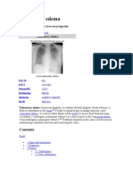 Pulmonary Edema