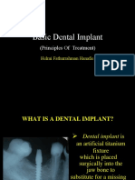 Basic Dental Implant