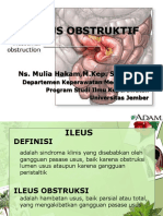 ILEUS OBSTRUKTIF