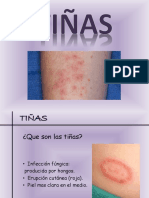 Tiñas