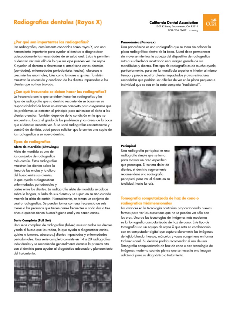 Xrays Spanish PDF PDF Dentistry X Ray