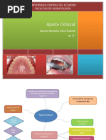 Ajuste Oclusal